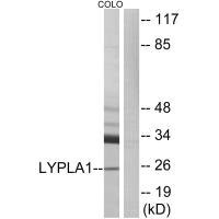 Anti-LYPLA1