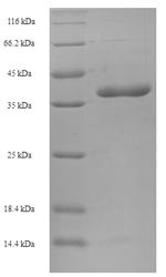 Bcl-2-like protein 11 (BCL2L11), human, recombinant