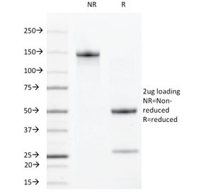 Anti-VEGF Receptor 2 / VEGFR2 / KDR, clone DC101