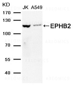 Anti-EPHB2