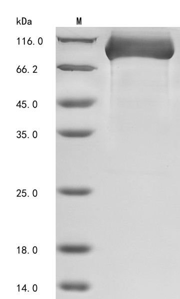 Dipeptidyl peptidase 4 (DPP4), partial, human, recombinant