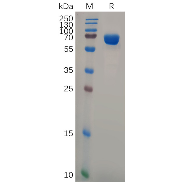 Human BST1 Protein, hFc Tag