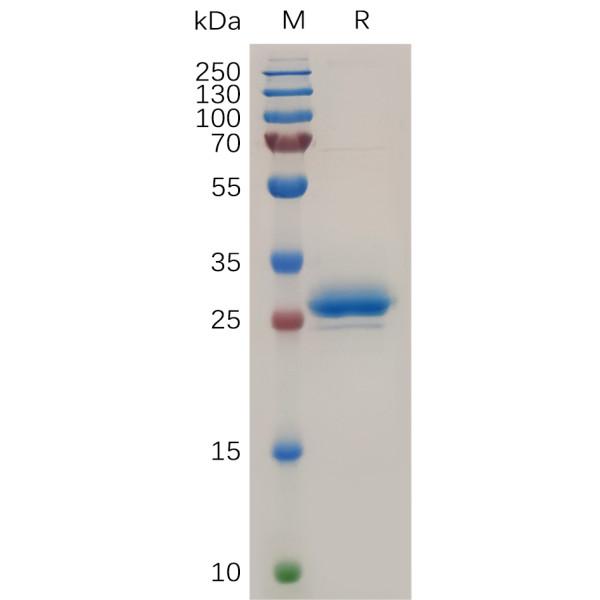 Human Mesothelin(37-286) Protein, His Tag