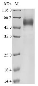 Interleukin-13 (IL13), human, recombinant