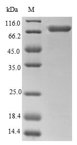 Calreticulin (CALR), human, recombinant