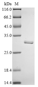 Carbonic anhydrase 2 (Ca2), rat, recombinant