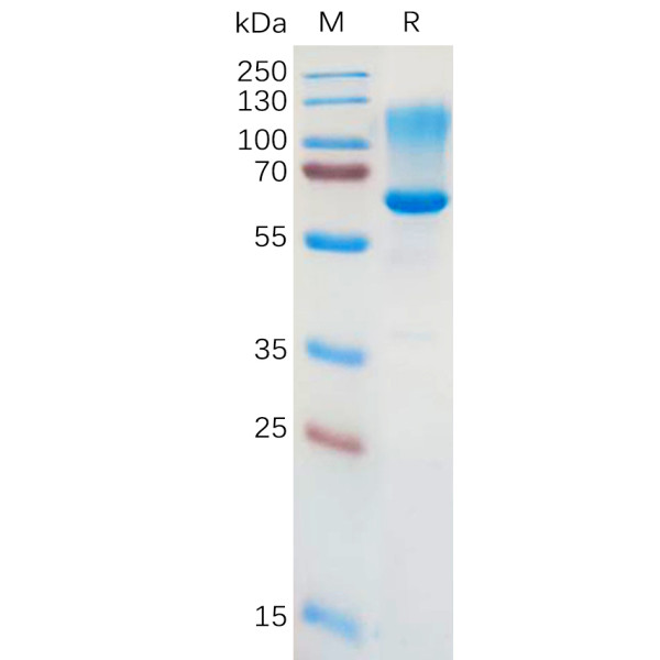 Human CD43 Protein, hFc Tag