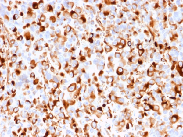 Anti-NGF-Receptor (p75) / CD271 (Soft Tissue Tumor Marker)(rNGFR/1965), CF594 conjugate, 0.1mg/mL