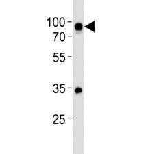 Anti-CD19