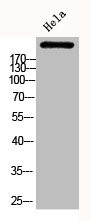 Anti-Phospho-ACACA (S80)