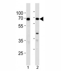 Anti-XRCC6