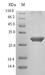 T-cell immunoreceptor with Ig and ITIM domains (TIGIT), partial, human, recombinant