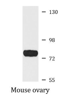 Anti-15 Lipoxygenase 2