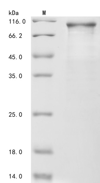 Catenin beta-1 (CTNNB1), human, recombinant