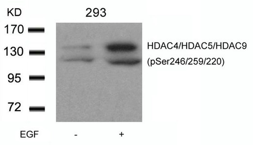 Anti-Phospho-HDAC4/HDAC5/HDAC9 (Ser246/259/220)