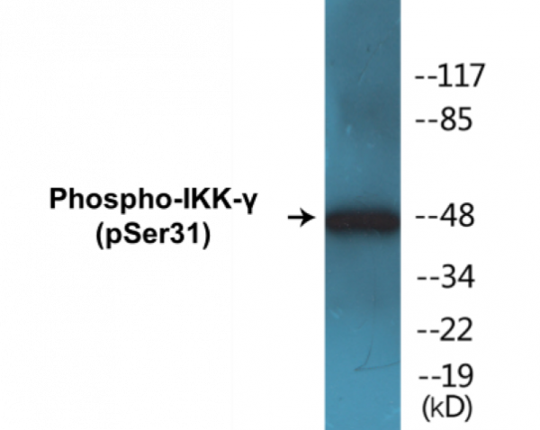 IKK-gamma (Phospho-Ser31) Colorimetric Cell-Based ELISA Kit