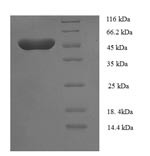 Transcriptional enhancer factor TEF-5 (TEAD3), partial, human, recombinant