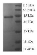 Nucleoside diphosphate kinase A (NME1), human, recombinant