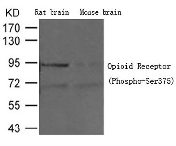 Anti-Phospho-OPRM1 (Ser375)