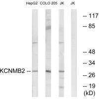 Anti-KCNMB2