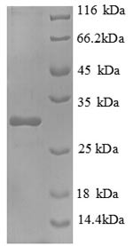 Interleukin-2 receptor subunit beta (Il2rb), partial, mouse, recombinant