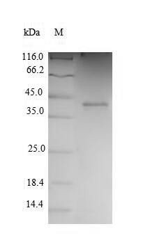 Cyclin-dependent kinase 2 (CDK2), human, recombinant