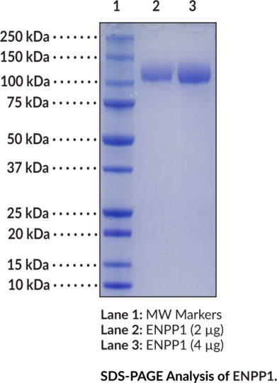 ENPP1 (human, recombinant)