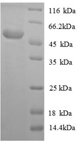 Acyl-protein thioesterase 1 (Lypla1), mouse, recombinant