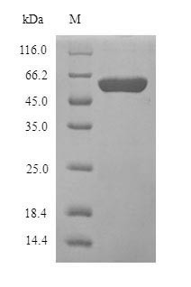 Amine oxidase [flavin-containing] B (MAOB), partial, human, recombinant