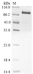 Poly [ADP-ribose] polymerase 2 (PARP2), human, recombinant