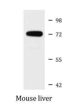 Anti-SQLE / Squalene Epoxidase