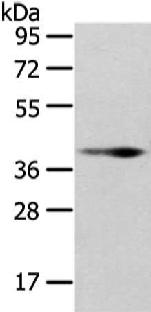 Anti-WNT10B