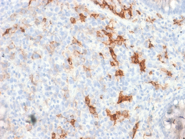 Anti-NGF-Receptor (p75) / CD271 (Soft Tissue Tumor Marker) (NGFR/1997R), CF488A conjugate, 0.1mg/mL