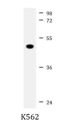 Anti-ATG4A, clone 1458CT808.66.25.69