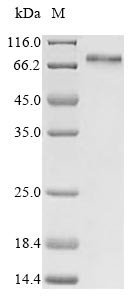 Transcriptional coactivator YAP1 (YAP1), human, recombinant