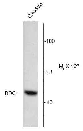 Anti-DOPA Decarboxylase