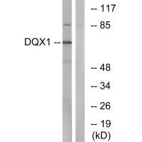 Anti-DQX1