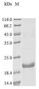 Gastric inhibitory polypeptide receptor (Gipr), partial, mouse, recombinant