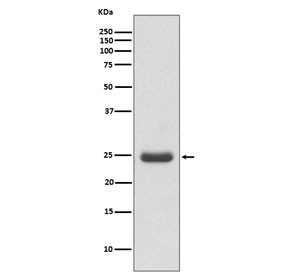 Anti-TK1 / Thymidine Kinase 1, clone AOBB-20