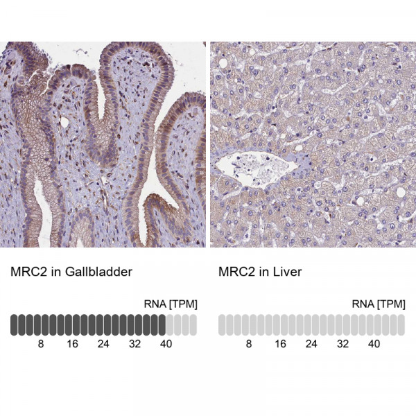 Anti-MRC2