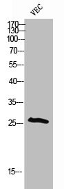 Anti-Phospho-CDKN1B (T198)