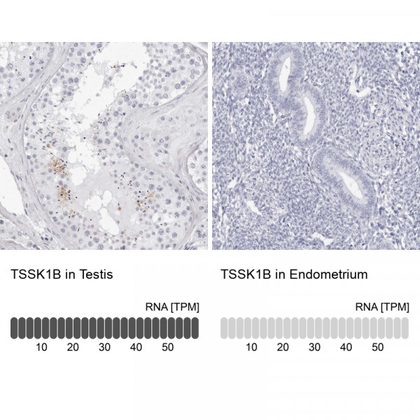 Anti-TSSK1B