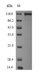 Angiotensin-converting enzyme (ACE2), partial (Active), Macaca fascicularis, recombinant