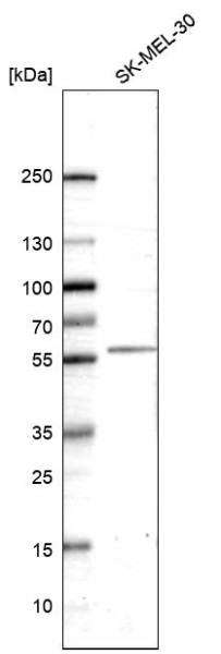 Anti-HTR2B, clone CL14576