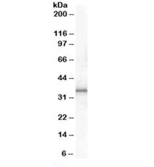 Anti-UCP1