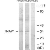 Anti-TNFAIP1