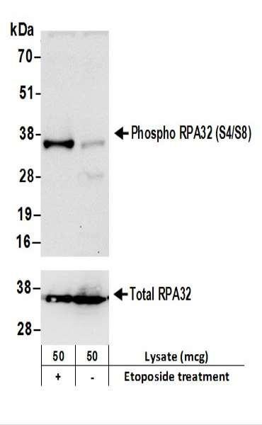 Anti-phospho-RPA32 (Ser4/Ser8)
