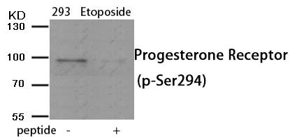 Anti-Phospho-PGR (Ser294)