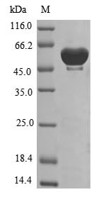 Tryptophan--tRNA ligase, cytoplasmic (WARS), human, recombinant