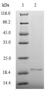 Proliferation marker protein Ki-67 (MKI67), partial, human, recombinant